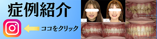 白く輝く健康的な歯へ！セラミック治療 1歯 43,780円(税込)〜