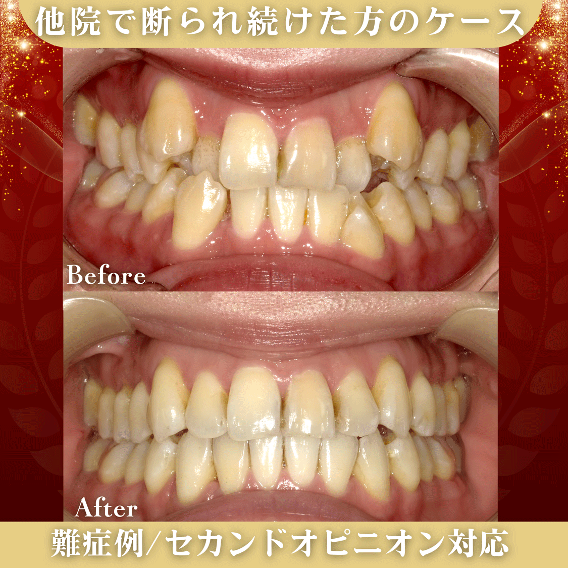 他院で断られ続けた方のケース